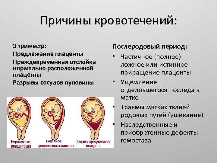 Предлежание плаценты картинки