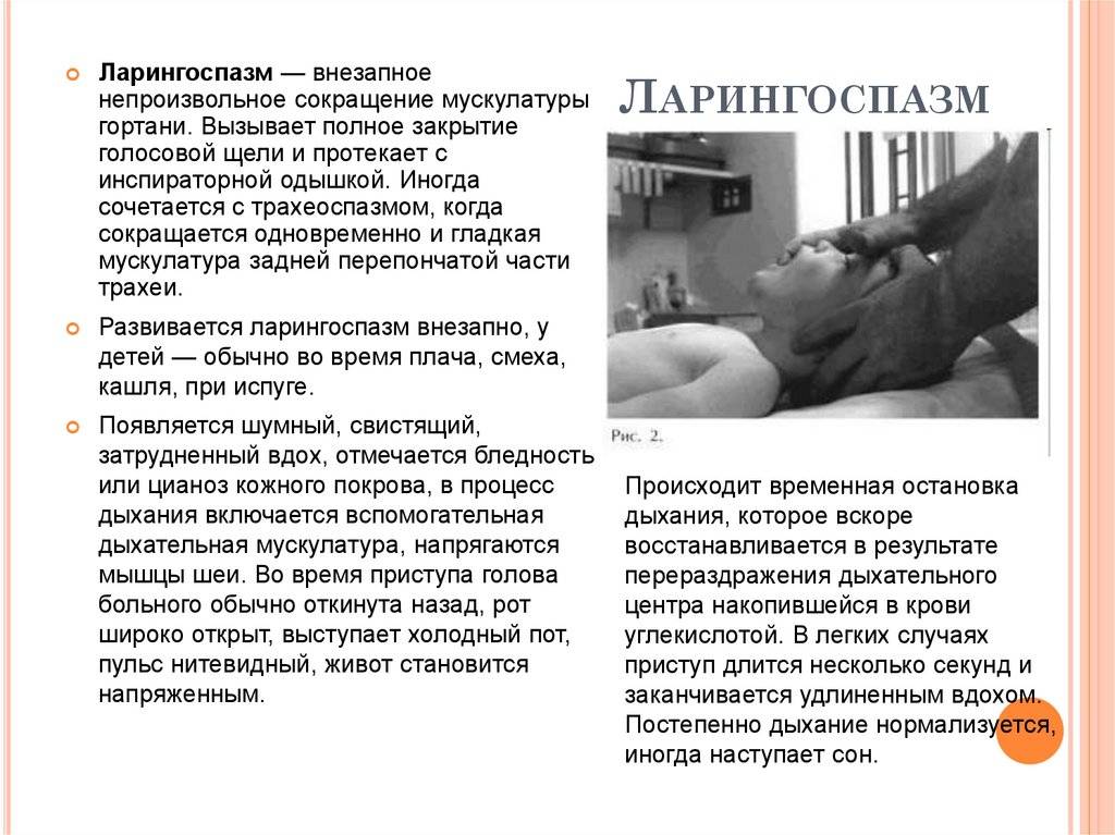 Судорожный синдром у детей — причины появления судорог, симптомы, способы профилактики