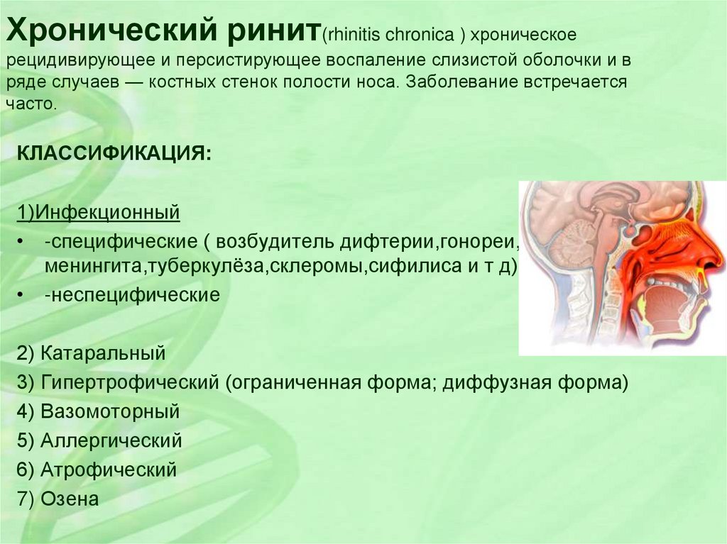 Ринит сочетающийся с субфебрилитетом является ведущим в клинической картине