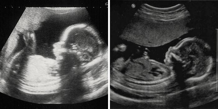 Что происходит с малышом на 21 неделе беременности (16 фото): развитие плода, как выглядит ребенок в 20-21 неделю, вес и размер, ощущения