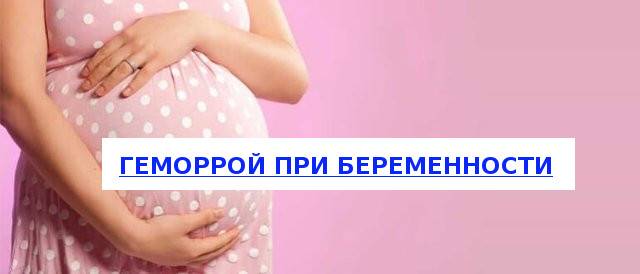 Лечение геморроя у беременных женщин