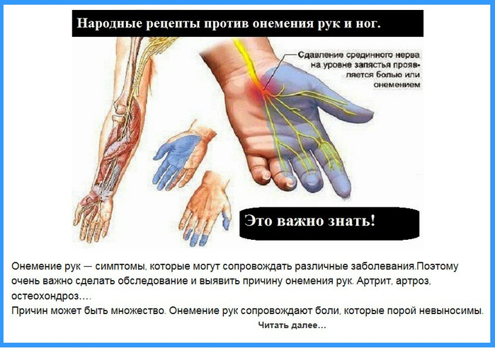 Сильно болят руки причины. Анимение пальцев налево руке. МНЕМТ пальцы на левой руке.