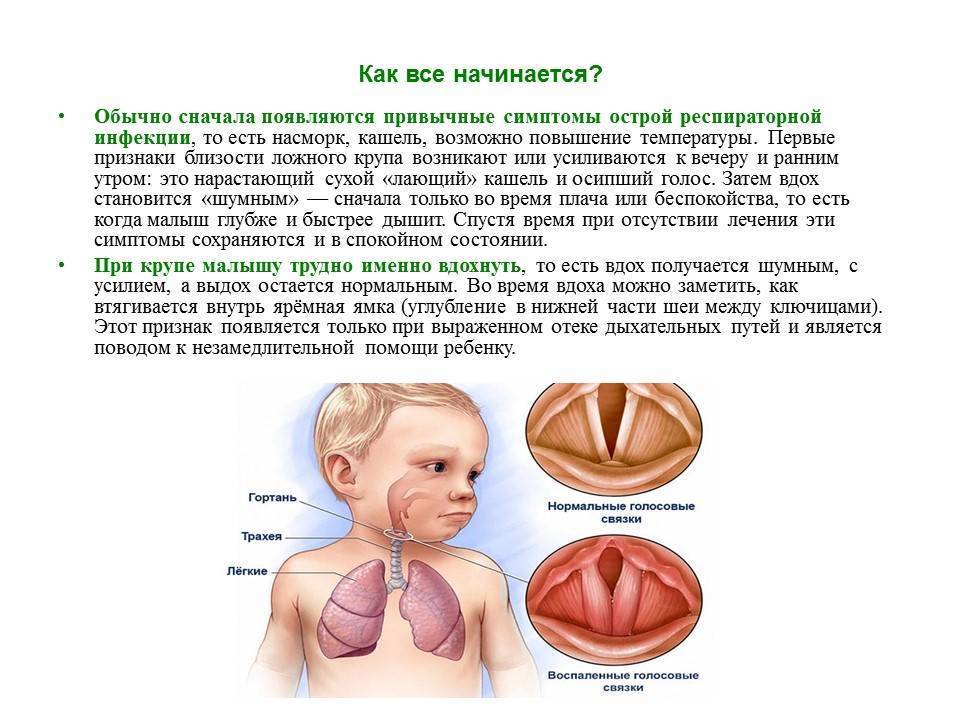 О ларингит карта вызова