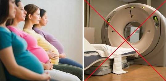 Можно ли делать рентген зубов беременным женщинам?