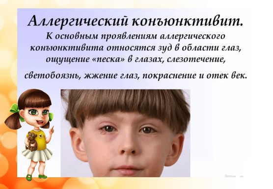 Вирусный конъюнктивит у детей - симптомы болезни, профилактика и лечение вирусного конъюнктивита у детей, причины заболевания и его диагностика на eurolab