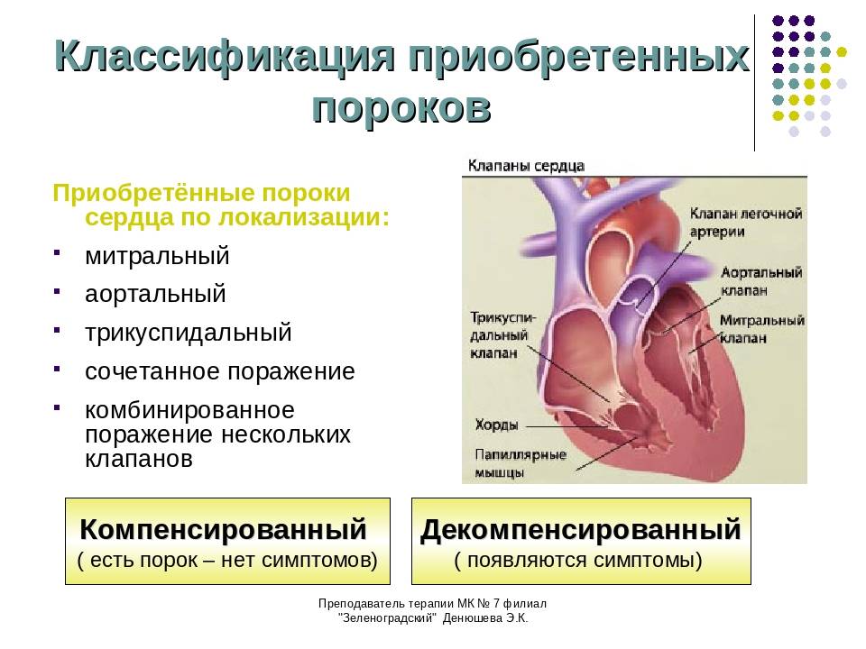 Блок схема пороки сердца