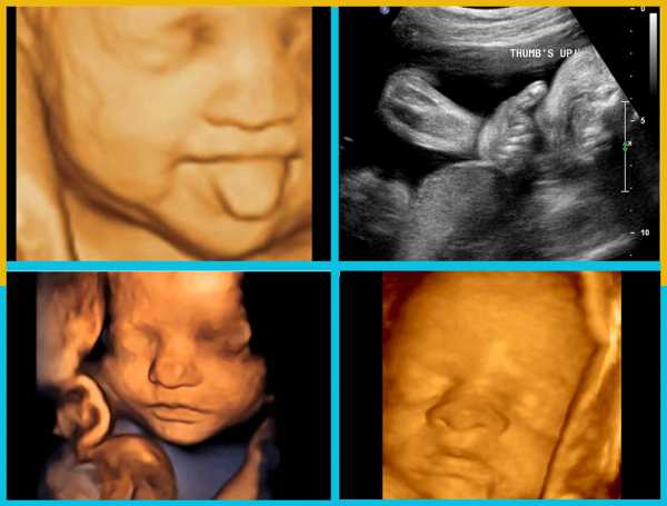 29 неделя беременности: как развивается малыш в утробе?