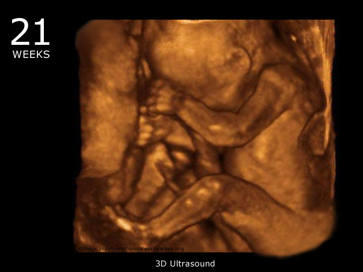 Срок беременности 1 неделя: врач рассказала об изменениях и признаках, возникающих сразу после зачатия
