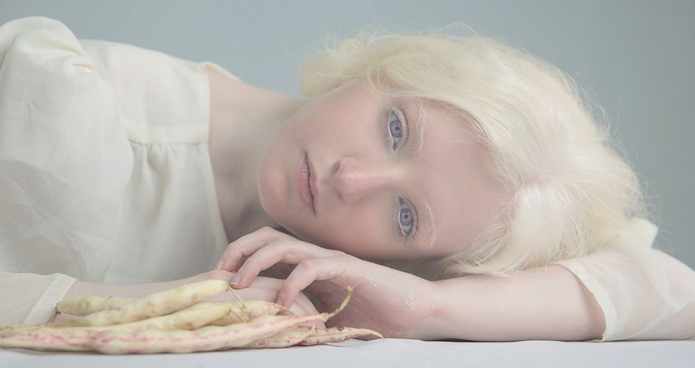 Муж альбинос. «белая ворона», или особенности здоровья и развития ребенка-альбиноса