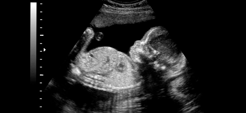 3d/4d ультразвуковое исследование при беременности