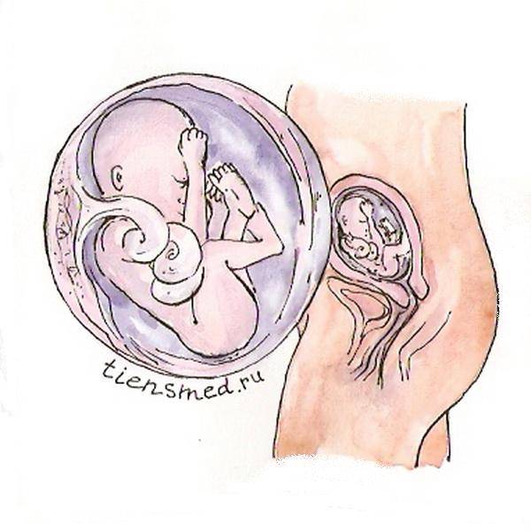 Многоплодная беременность — большая медицинская энциклопедия