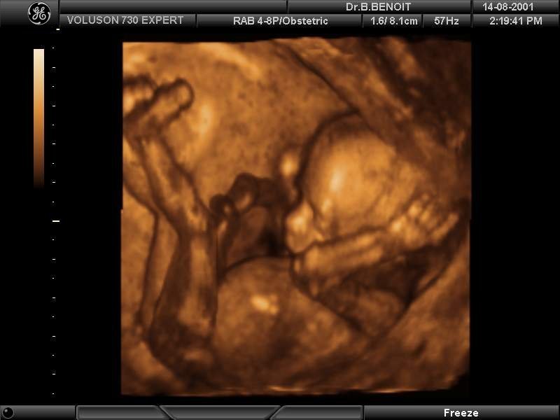 21 неделя беременности фото малыша