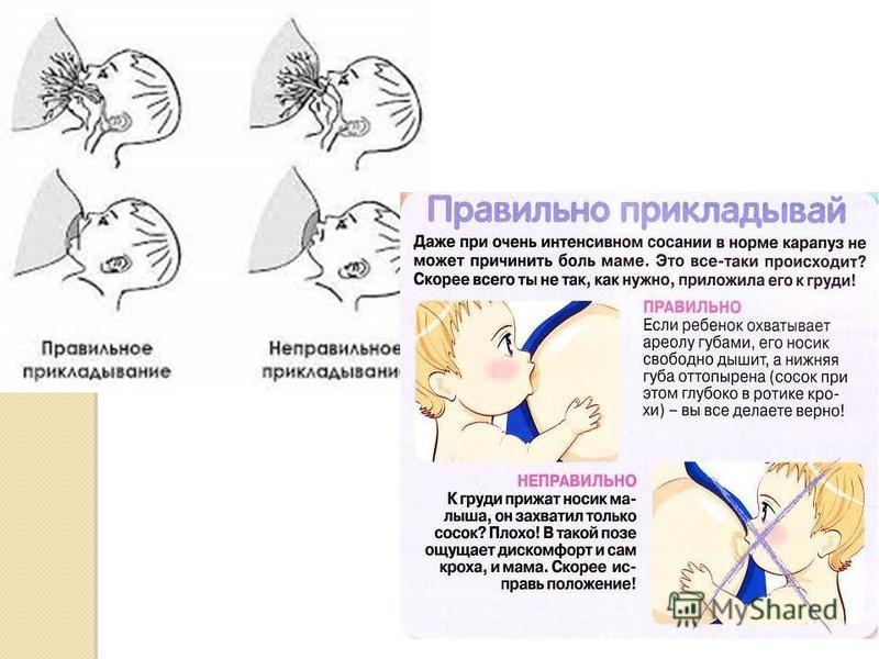 Как правильно прикладывать ребенка к груди фото