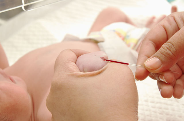 Как берут кровь из вены у новорожденного, грудничка, подготовка к анализу крови из вены