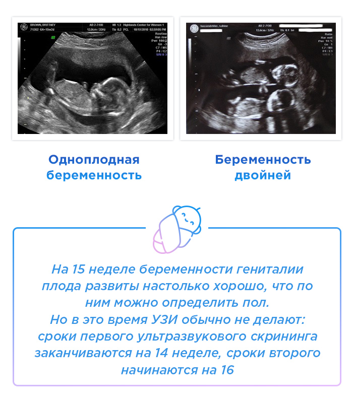 Срок беременности по узи
