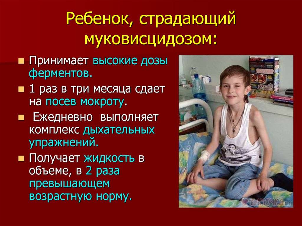 Кистозный фиброз фото