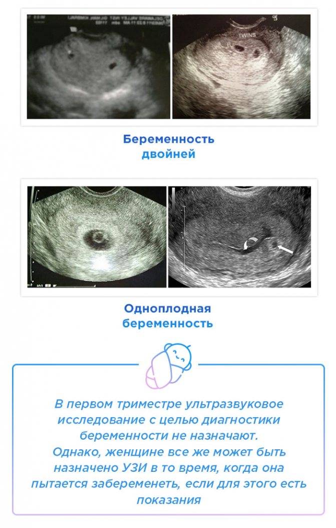На узи по беременности срок меньше или больше, чем по месячным — почему и стоит ли волноваться?