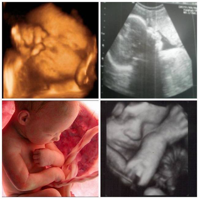 32 неделя беременности: ощущения, развитие плода, третье плановое узи