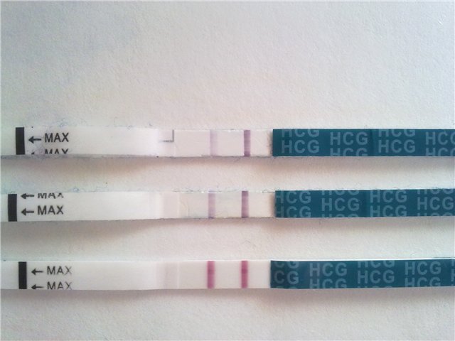 Тест полоска при внематочной беременности фото
