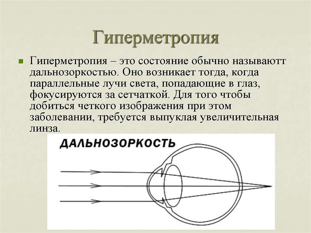 При дальнозоркости изображение возникает