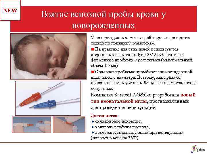 Как подготовить младенца к сдаче крови из вены?