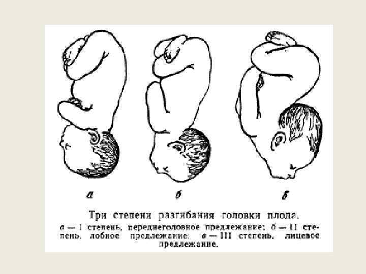Когда ребенок переворачивается в животе вниз головой и принимает правильное положение (позу) перед родами