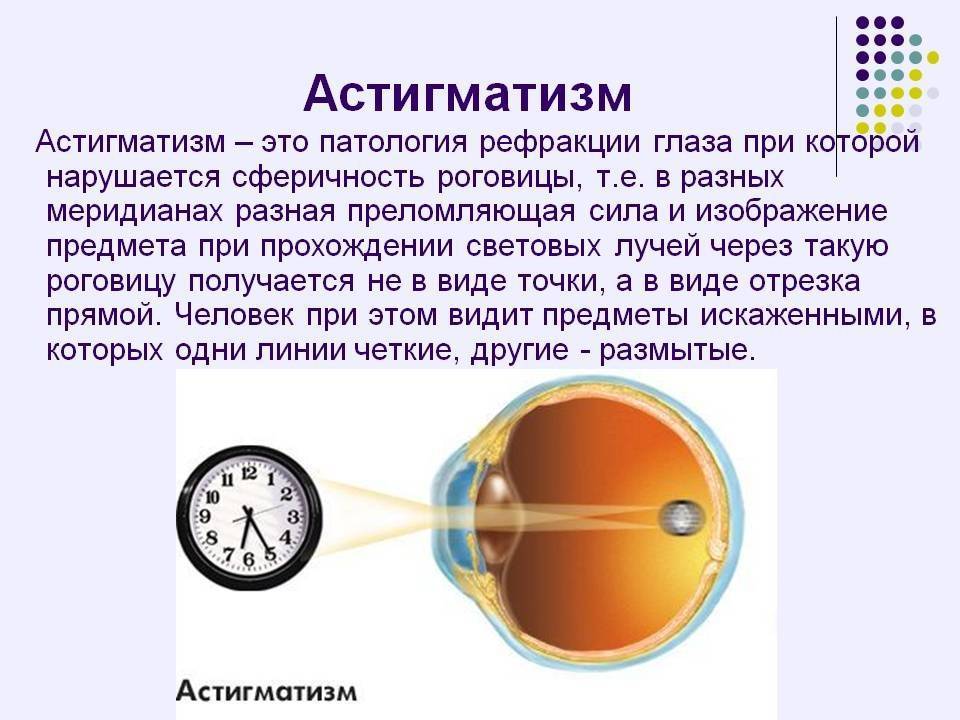 Лечение дальнозоркости у детей: как лечить детскую гиперметропию? - детская поликлиника № 7