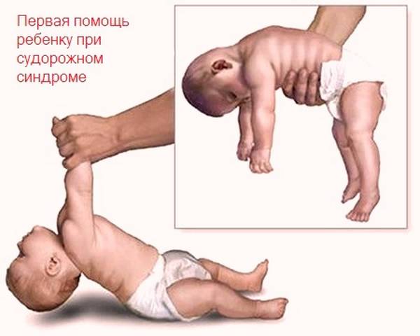 Насморк у грудничка