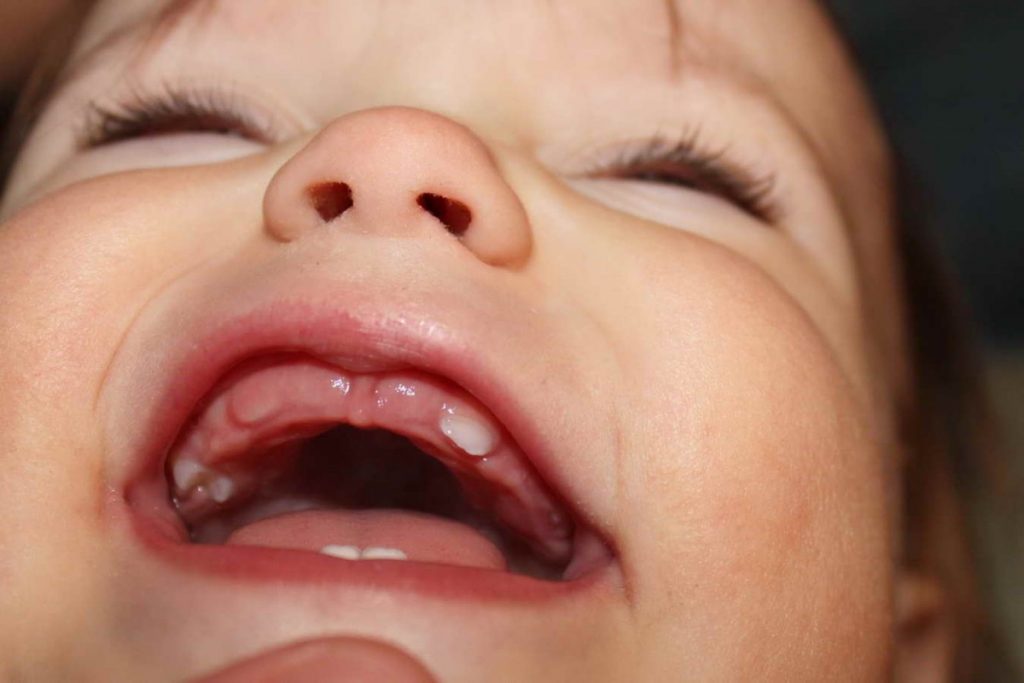 Коренные зубы у детей – симптомы прорезывания зубов, осложнения, уход