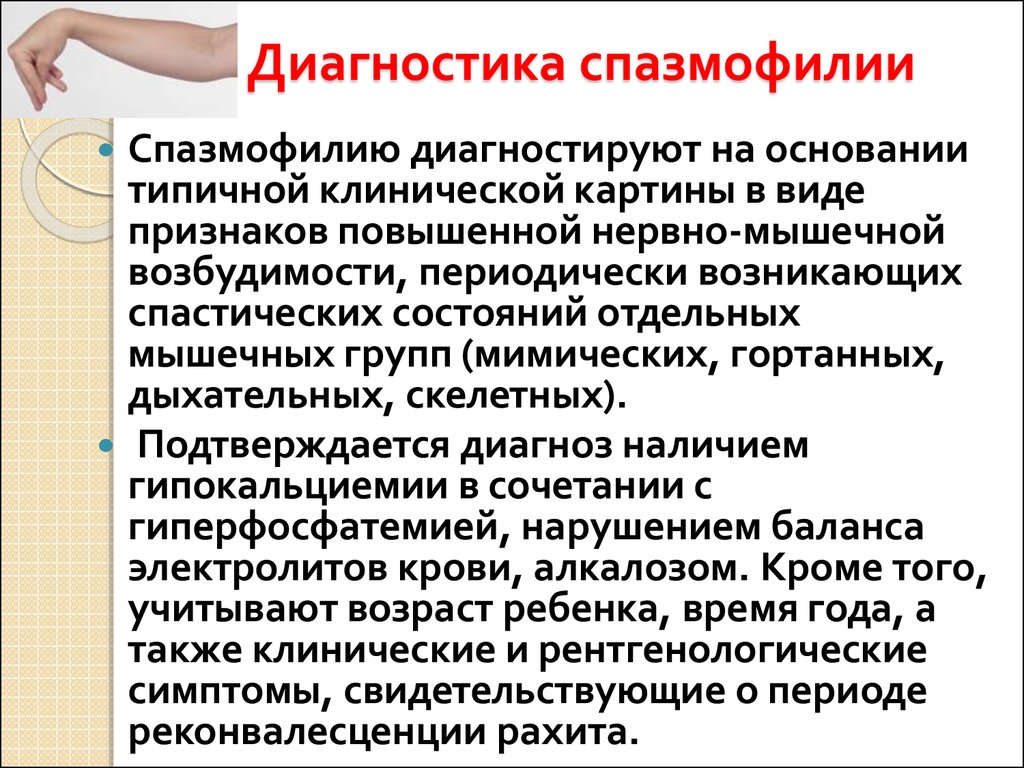 Спазмофилия клинические