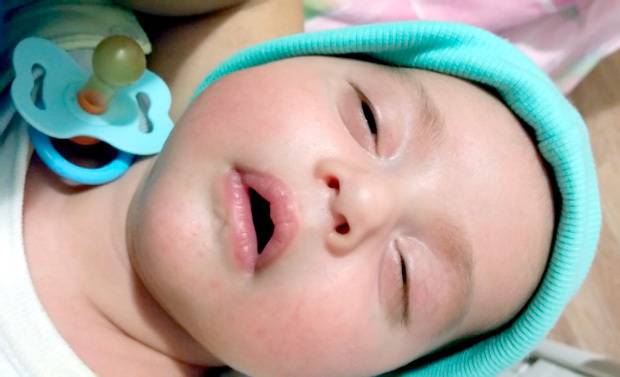 Почему ребёнок спит с приоткрытыми глазами