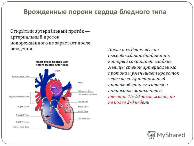 Как распознать врождённый порок сердца у ребёнка? Практические рекомендации от детского кардиолога