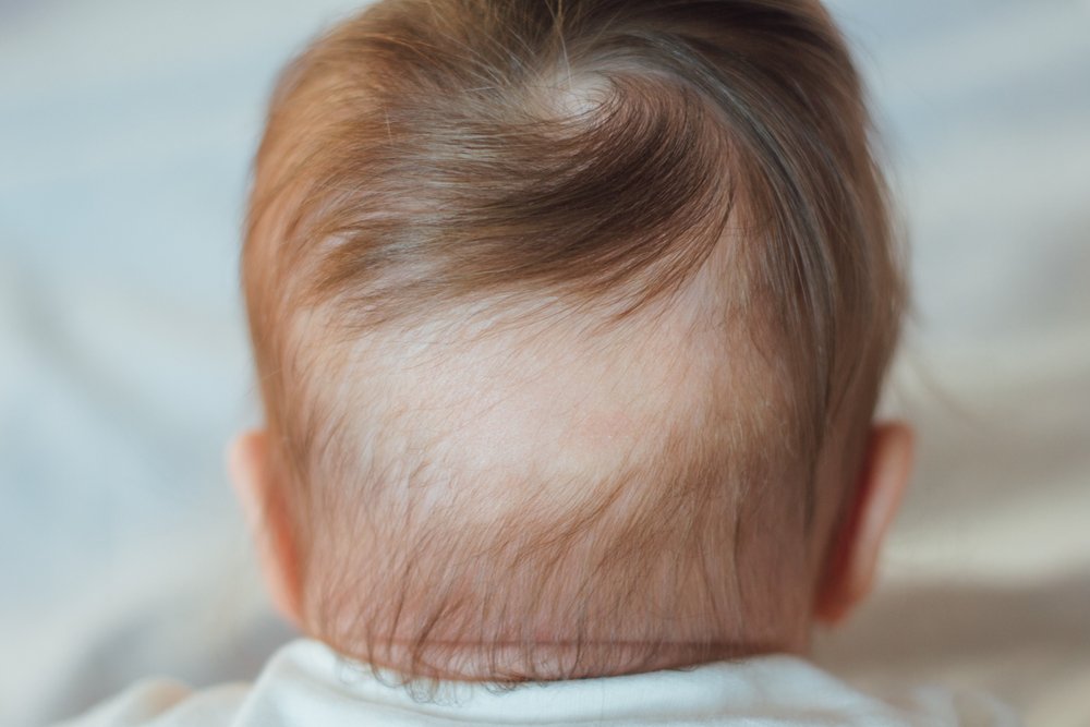 Почему ребенок рождается со светлыми волосами
