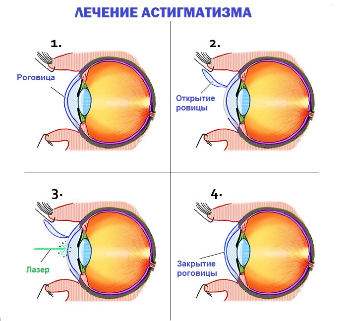 Изображение видимых предметов формируется на а роговице б