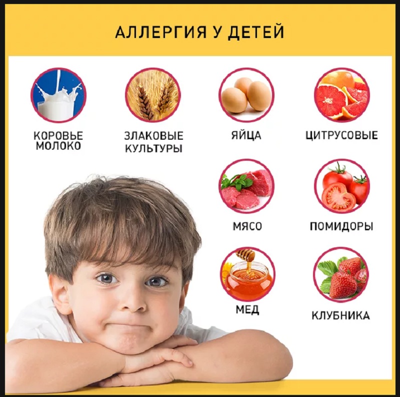 Аллергия у детей — виды, симптомы, лечение