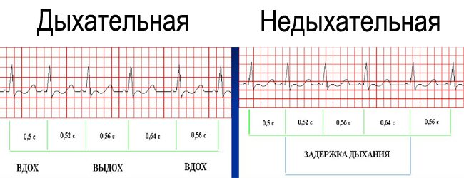 Детский кардиолог в новосибирске | цены, отзывы, врачи, записаться на консультацию в «сердолик»