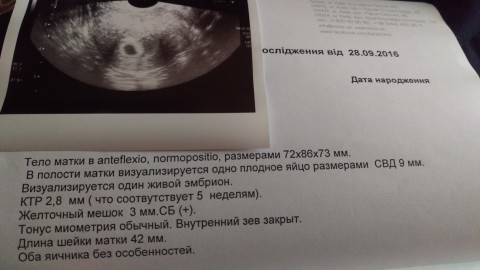 Срок 5 недель беременности. УЗИ на 5 акушерской неделе беременности. УЗИ 5 недель беременности УЗИ. Плод на 5 неделе беременности УЗИ. УЗИ беременной 5 недель.