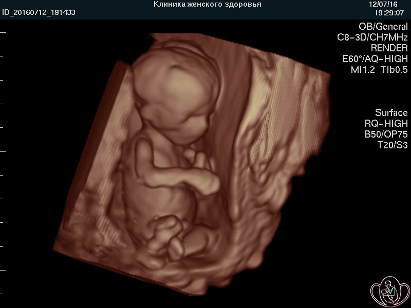 Беременность — 16 недель. развитие малыша, что происходит с мамой