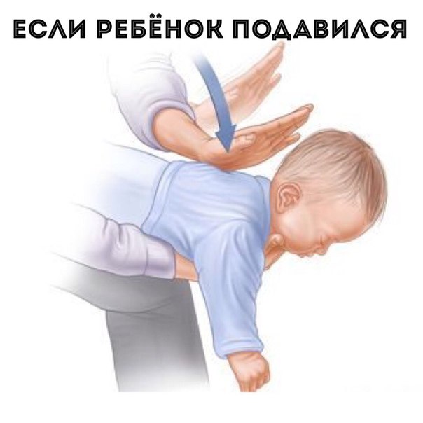 Что делать, если ребёнок подавился? Инструкция от врача-педиатра