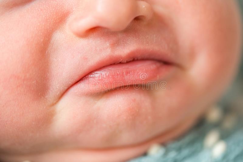 Белые губы у ребенка норма или молочница
