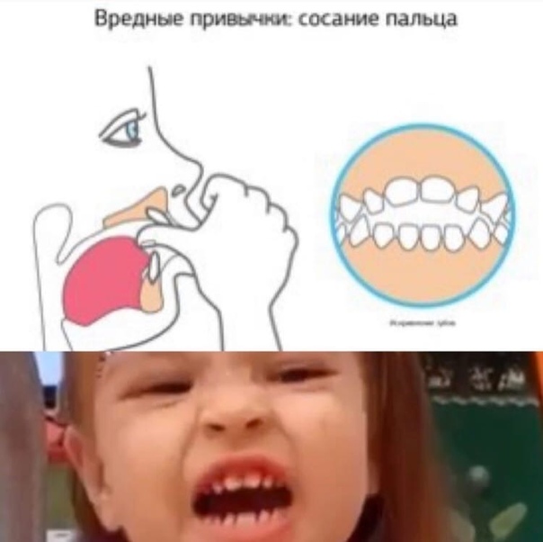 Ребенок берет пальцы в рот: что делать?