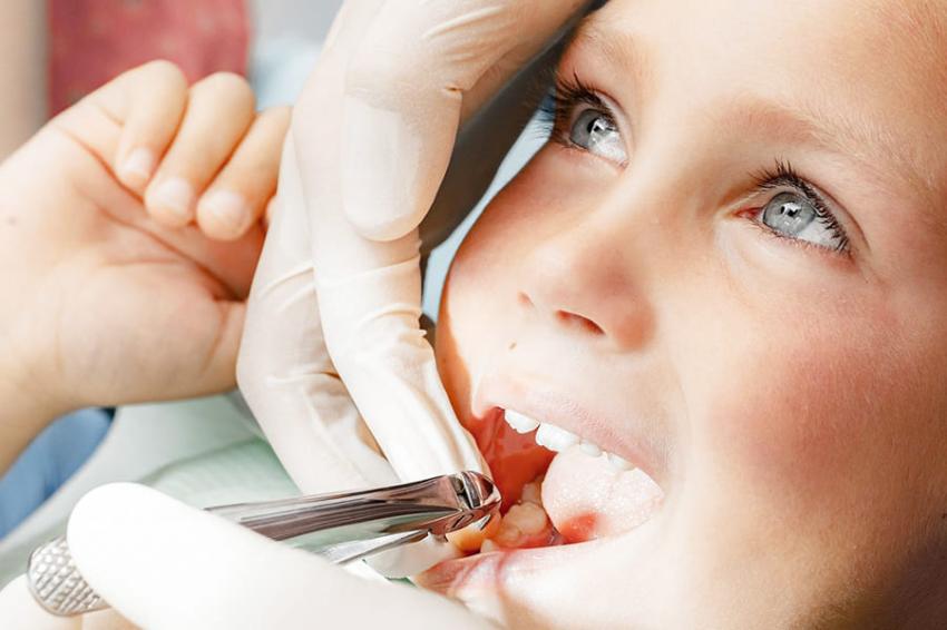Как не больно вырвать зуб дома - советы стоматологов
