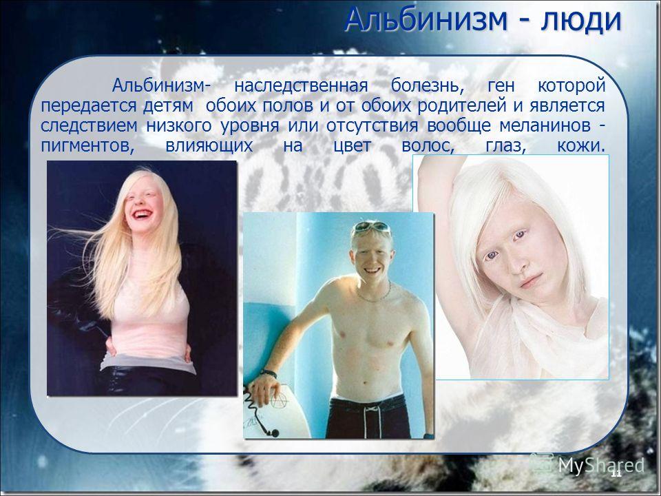 Сообщество пациентов с альбинизмом