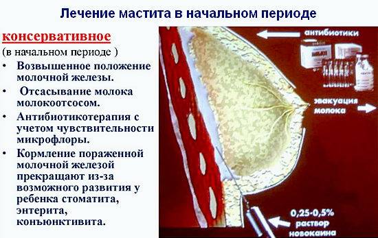 Послеродовой мастит. Нелактационный Гнойный мастит. Мастит воспаление молочных желез. Консервативная терапия при мастите.