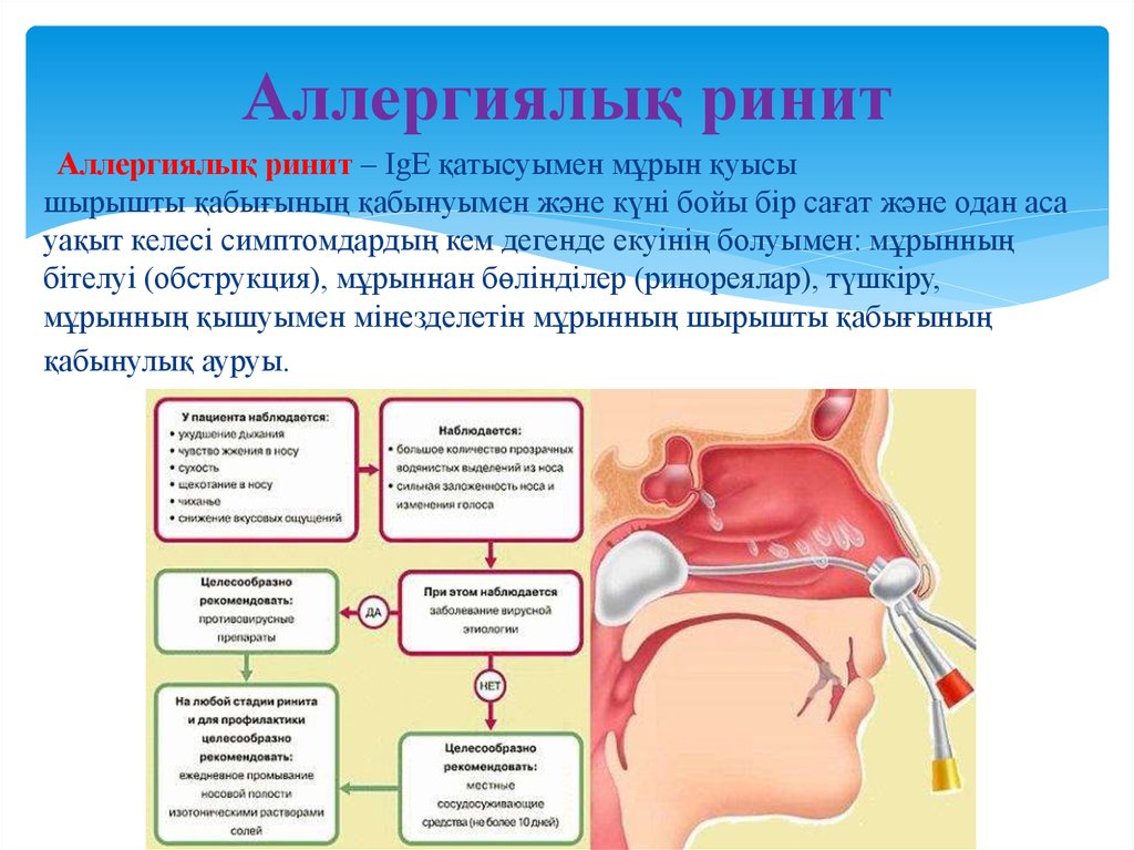 Синуситы лор презентация