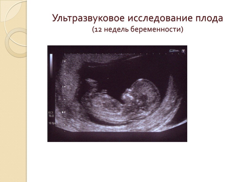 12 неделя беременности. календарь беременности