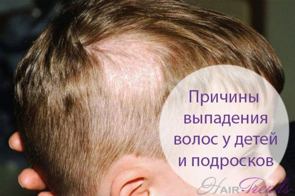 Почему у новорожденного выпадают волосы на голове комаровский