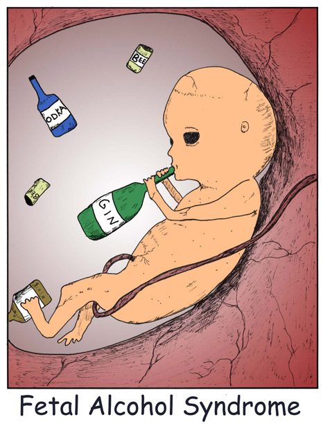Материнство: влияние алкоголя на беременность