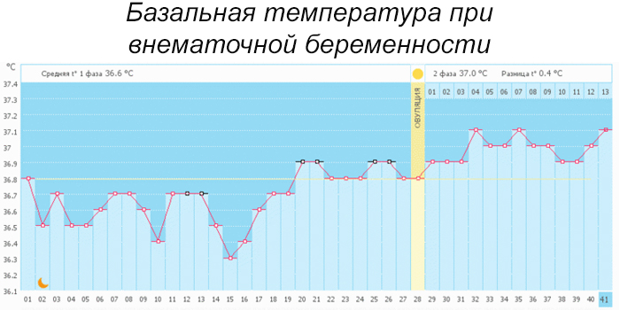 Сколько температура при беременности. БТ при внематочной беременности. График беременности базальная температура. График базальной температуры при внематочной. Внематочная беременность базальная температура.