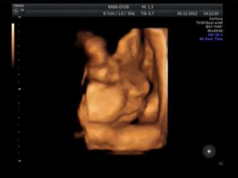3 скрининг при беременности: протокол проведения, анализы, нормы, узи